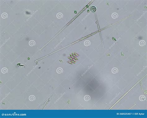 Diatoms, Algae Under Microscopic View, Phytoplankton, Fossils, Silica ...