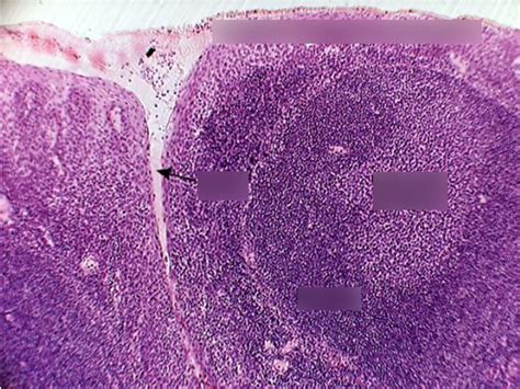 Pharyngeal Tonsils Histology Labeled