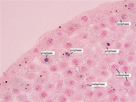 Whitefish Blastula with Mitosis Stages Labeled (400X) | Flickr