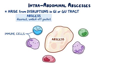 Intra Abdominal Abscess