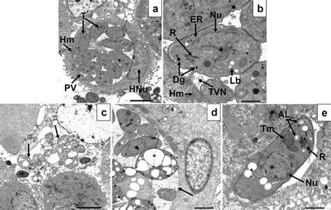 TEM images of Toxoplasma gondii-infected, non-treated (a, b) and... | Download Scientific Diagram