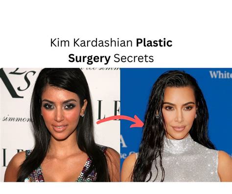 Kim Kardashian Plastic Surgery Before And After 2022