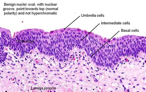 urinary bladder-histology - www.medicoapps.org