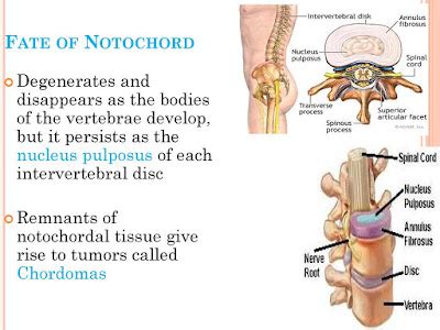 EXAMS AND ME : Notochord