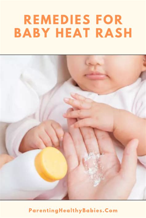 Baby Heat Rash: 15 Must Know Home Remedies For Baby Heat Rash | Heat ...