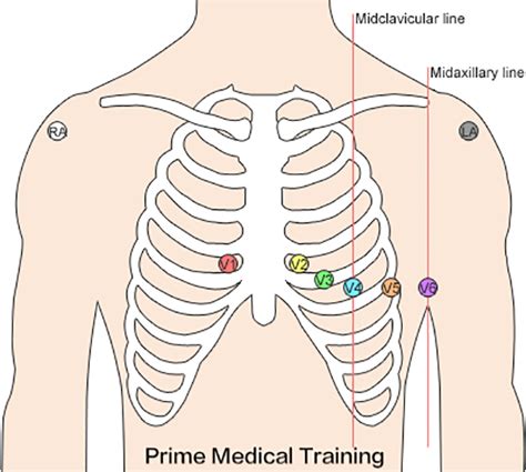 The Ultimate 12-Lead ECG Placement Guide (With Illustrations)