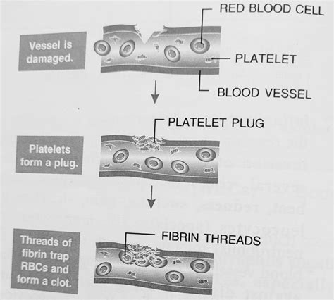 Explain the Process of Blood Clotting Class 10 - CBSE Class Notes Online - Classnotes123