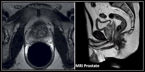 SWSLHD - Medical Imaging - MRI Prostate