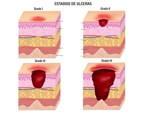 Catedral Críticamente pérdida parches para escaras como se usan Puro Obediencia Padre