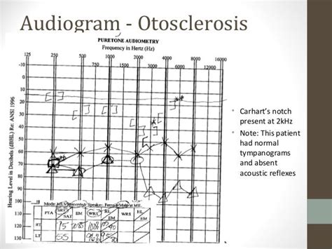 Medical Imaging, Otitis Media, & Otosclerosis