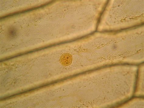 The inner epidermis of the onion bulb’s cataphylls (the onion skin).