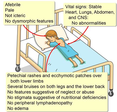 Fanconi Anemia Symptoms