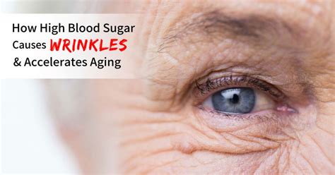 How High Blood Sugar Causes Wrinkles & Accelerates Aging | Dr. Sam Robbins