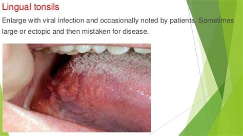 Principle diagnosis