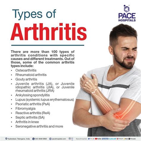 Arthritis: Symptoms, Types, Causes, Risk Factors, Complications