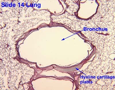 Bronchus Slide Labelled