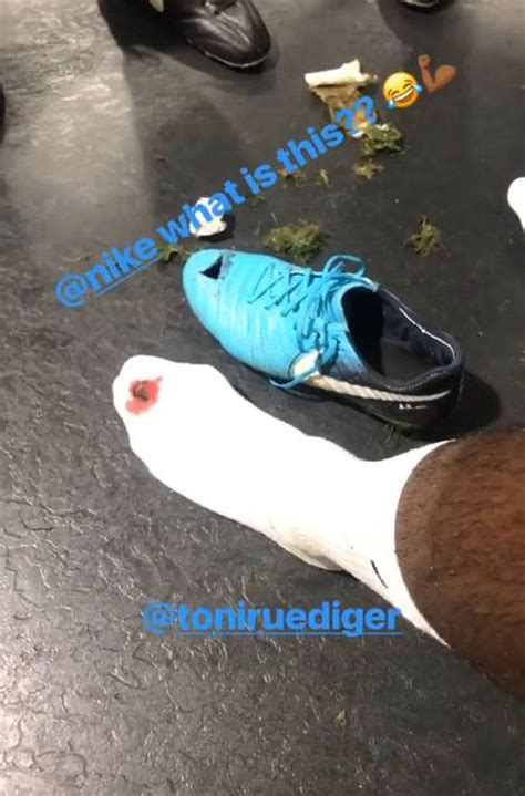 Antonio Rudiger injury: Chelsea star shows off blooded foot and ripped ...