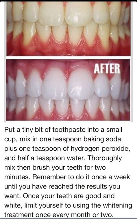 toothpaste, baking soda, hydrogen peroxide to whiten teeth! sounds awesome, but for some reason ...