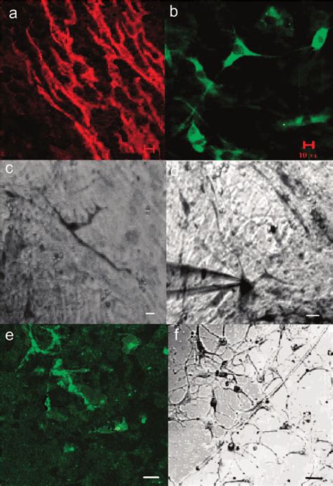 Culture and identification of interstitial cells of Cajal (ICC ...