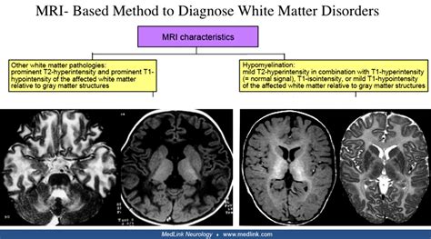 rsl1 | MedLink Neurology