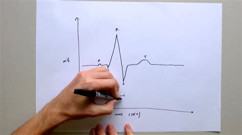 Draw a normal ECG tracing - candidate answer on Vimeo