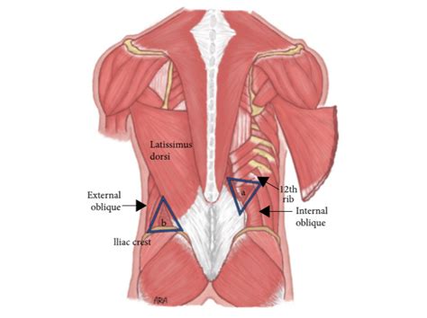 Lumbar Triangle Cadaver