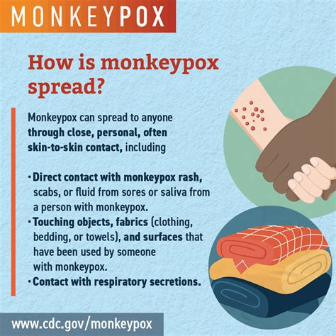 MedlinePlus.gov on Twitter: "RT @CDCgov: Did you know that monkeypox ...