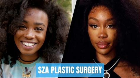 Sza Before And After Plastic Surgery: Everything You Need To Know!