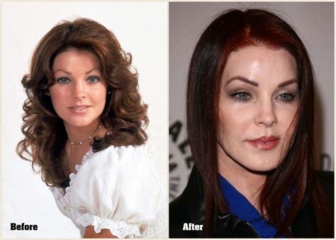 Priscilla Presley Plastic Surgery Before and Af...