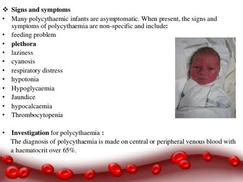 Polycythemia Vera Symptoms