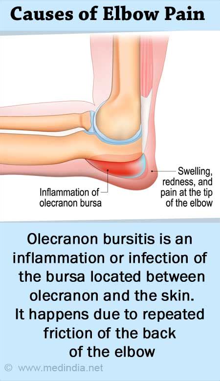 Elbow Swelling