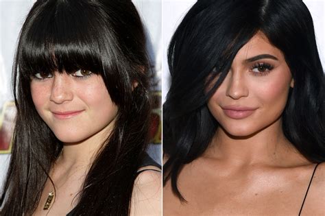 Kylie Kardashian Before And After