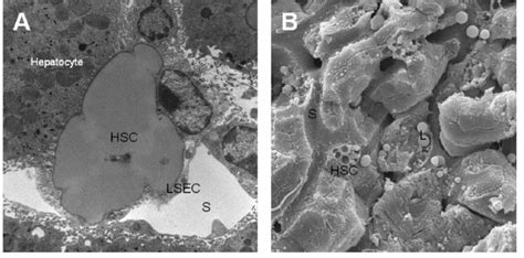 Electron micrographs of stellate cells from an old mouse. A ...