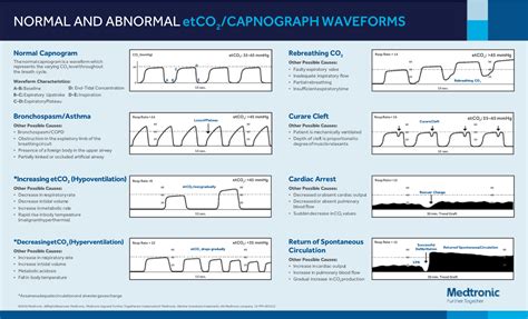 Normal and abnormal capnography waveforms infographic - CapnoAcademy ...