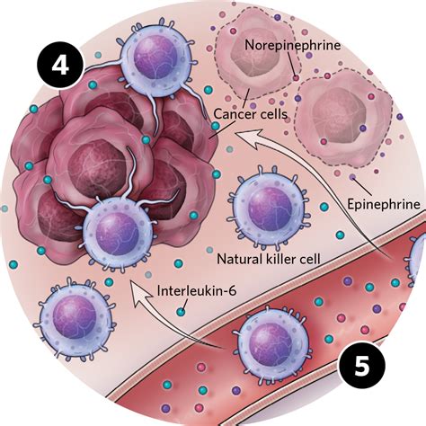 Infographic: Exercise’s Anticancer Mechanisms | The Scientist Magazine®