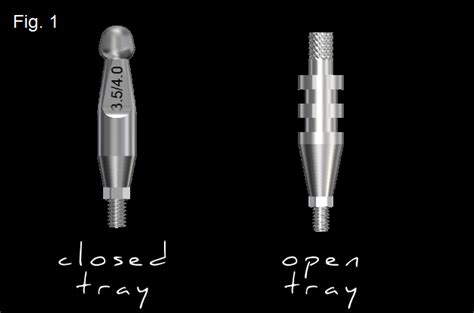 Closed Tray vs. Open Tray Implant Impressions - Spear Education