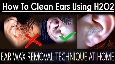 where can i get an ear cleaning - Lorri Slocum