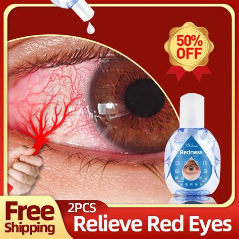 Red Eyes Treatment Products Apply To Relieves Eyes Infection Dry Itchy ...