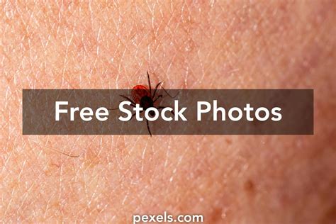 Tick Bite Photos, Download The BEST Free Tick Bite Stock Photos & HD Images