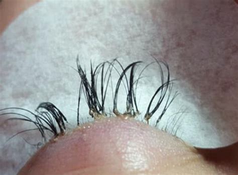 Beauty expert issues warning after woman’s eyelash extensions cause her real ones to fall out ...