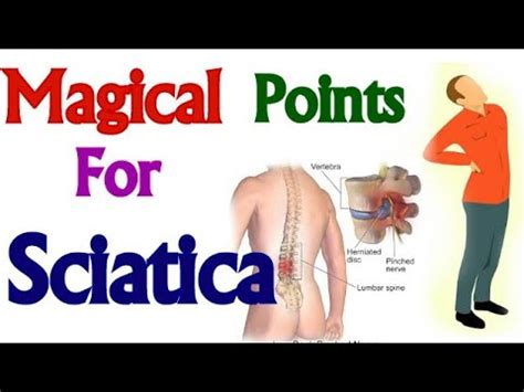 Acupressure Points For Sciatica Leg Pain : How acupuncture works for sciatica | Transformational ...