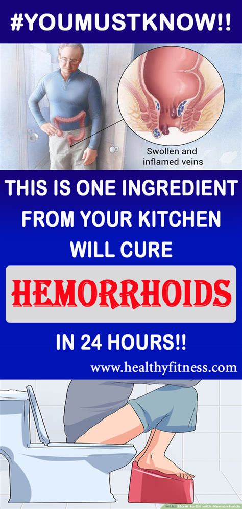 THIS SIMPLE REMEDY CAN CURE YOUR HEMORRHOIDS IN JUST 20 MINUTES !!! - world of health