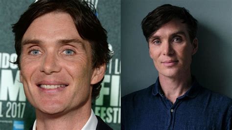 Cillian Murphy Before And After Plastic Surgery