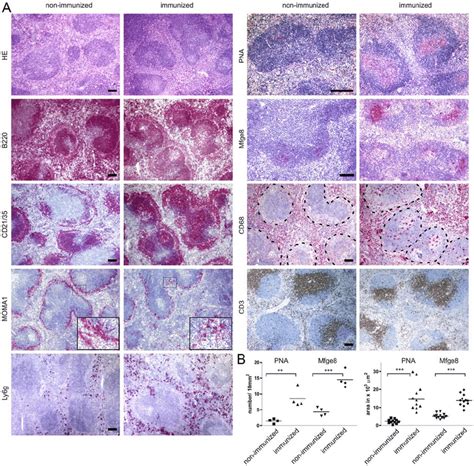 Histology Of Spleen