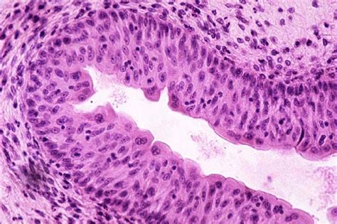 Transitional epithelium | Histology slides, Anatomy and physiology, Microscopic cells