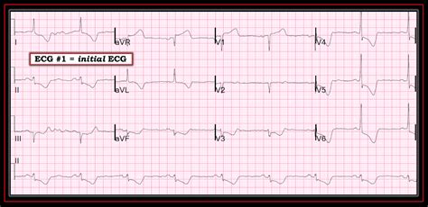 Dr. Smith's ECG Blog: The 4 Physiologic Etiologies of Shock, and the 3 Etiologies of Cardiogenic ...