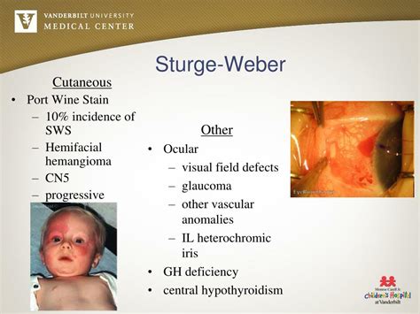 PPT - Neurocutaneous Disorders PowerPoint Presentation, free download - ID:4501574