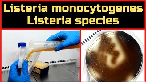 Detection of Listeria monocytogenes & Listeria species_Complete ...