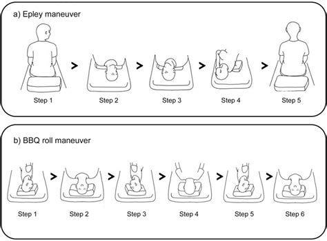 (a) Epley maneuver procedure steps. (b) Barbeque (BBQ) roll maneuver ...