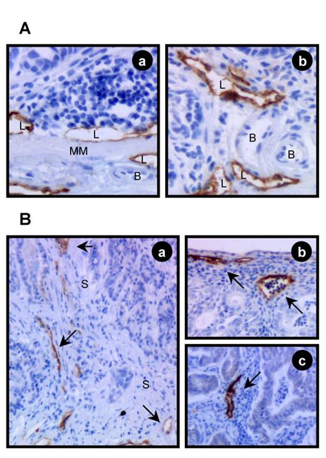 Immunohistochemical staining of lymphatic vessels by the LYVE-1 ...